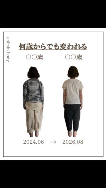 72歳から74歳、2年間の母の変化です🕊️✨

年齢とともに骨格のバランスが変わり、どうしても姿勢が崩れやすくなってしまいますよね。

私が行っている「骨格ベクトレ」は、
重力を味方につけて身体を整えていく施術です💎

激しい運動や食事制限は行いません🙅‍♀️
だからこそ、年齢を重ねても
無理なく続けやすいのが特徴です☺️

私自身、看護師としてこれまで多くの患者さんのリハビリに関わり、
膝や腰の痛みを抱える方に運動をお勧めしてきました。
でも心の中では、
「こんなに辛いのに、本当に運動をしなければいけないのかな…」
と葛藤することもありました。

もちろん、リハビリが必要な場面はたくさんあります。

ただ、「こんなやり方もあるんだ」という選択肢を、
少しでも多くの方に知ってほしい。

そして、何歳になっても自分の身体をケアしながら、
元気に動ける身体でいてほしい。

そんな想いで、この施術をお届けしています🍀

少しでも興味を持っていただいた方へ
🎁骨格タイプ診断を無料でプレゼント中🎁です！

この機会にぜひ、ご自身の身体と向き合ってみてください✨
（詳細はプロフィールのリンクから🔗）

#骨格ベクトレ福岡 
#姿勢改善 
#美容好きさんと繋がりたい